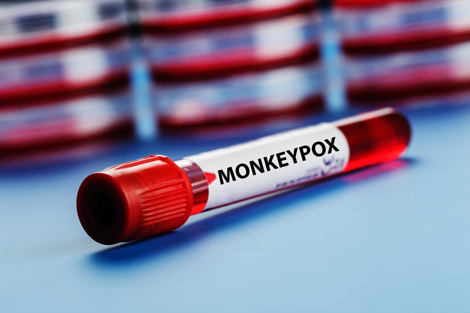 5,236 suspected Mpox cases reported in DR Congo, 229 deaths: WHO
