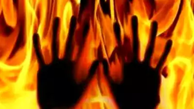 48-YEAR-OLD TEACHER ALLEGEDLY SET ON FIRE